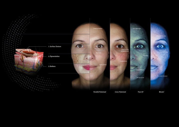 Unlock perfect skin with revolutionary technology, Advanced 3D Skin ...