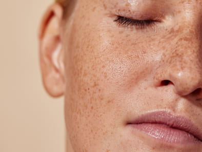 Treatments for Tired Skin